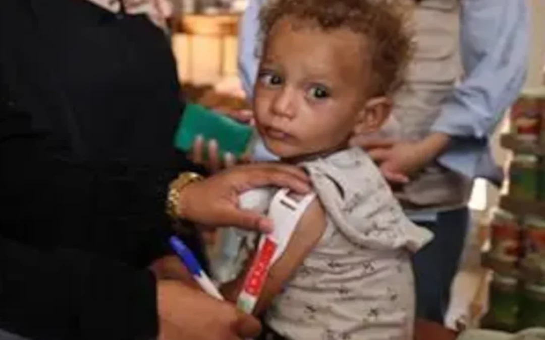 Álava envía 50.000 euros para combatir la hambruna infantil en Gaza
